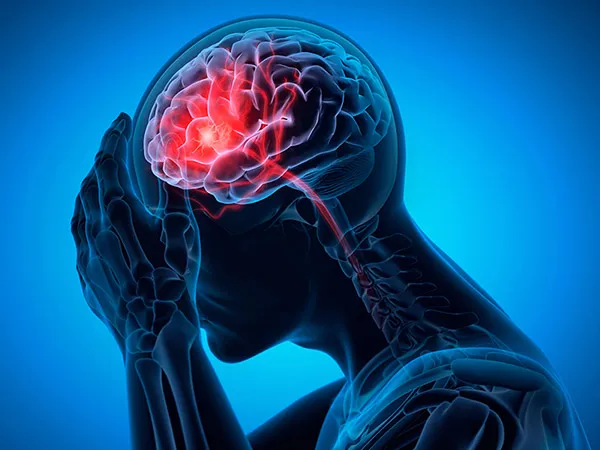 Recognizing the First Signs of a Stroke & Why Every Minute Counts